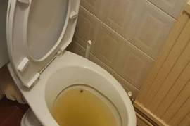 ელექტო ტროსი თხუნელა , ტრაპის გაწმენდა 579296263
